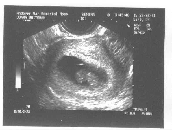 The first picture of new baby whiteman